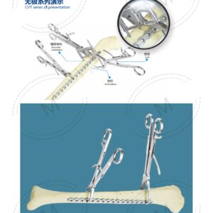 Dụng cụ kết hợp xương 188 2. 创伤系列产品图册 Trauma 55 1